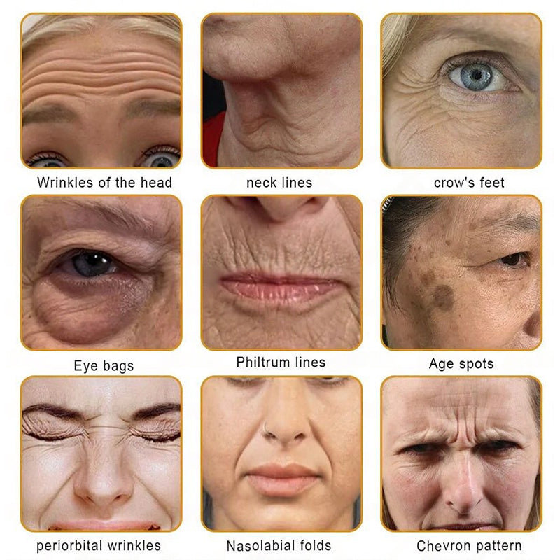 【Official Shop】RAINDEW® 9-IN-1 BEE VENOM & GHK-Cu Skin Firming & Treatment Cream Anti-aging, Hydrating, Skin Repair, Even Tone, Acne and Dark Spot Treatment, Wart and Mole Removal, Psoriasis Relief