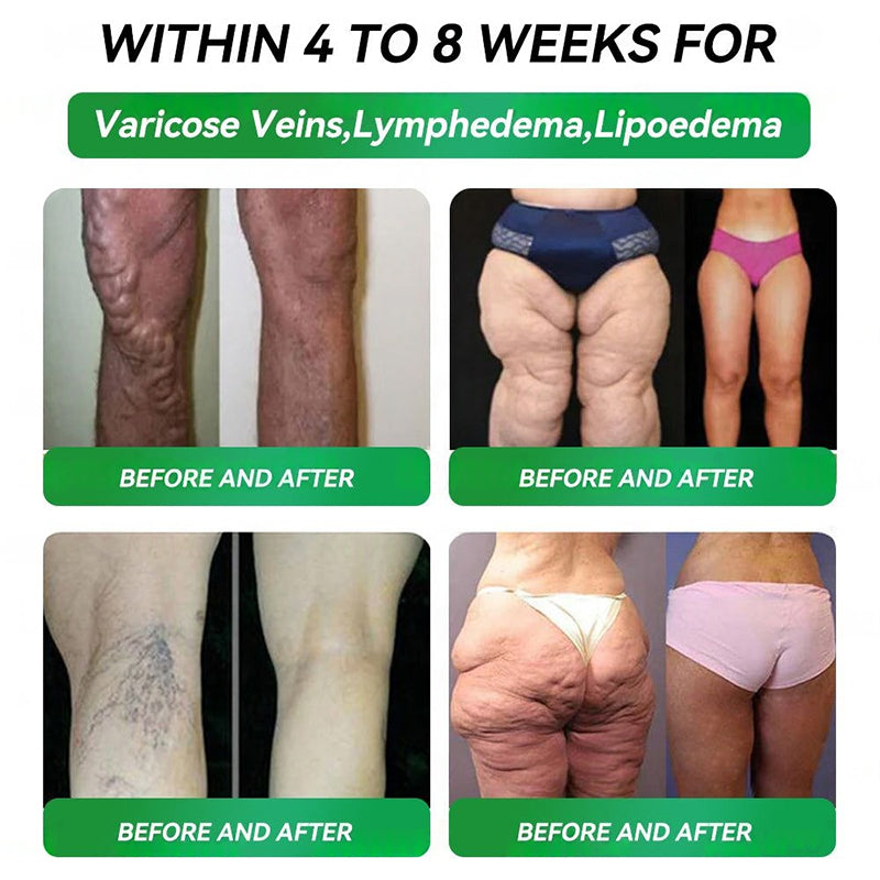 đşđ¸Official Store | HONXIÂŽ NAD+ GLP-1 Nine in One Health Oral Liquid(đđŽđŹđ đ¨đ§đđ đ đđđ˛, đŻđ˘đŹđ˘đđĽđ đđĄđđ§đ đđŹ đ˘đ§ đ đđđ˛đŹďź â
 đ
đ¨đŤ đ¨đđđŹđ˘đđ˛, đđđŤđđ˘đ¨đŻđđŹđđŽđĽđđŤ đĄđđđĽđđĄ, đđ˘đđđđđđŹ, đŹđĽđđđŠ đđŠđ§đđ, đđŽđ đđđđĽđđĄ, đŁđ¨đ˘đ§đ đ˘đŹđŹđŽđđŹ, đđ§đ đŚđ¨đŤđ