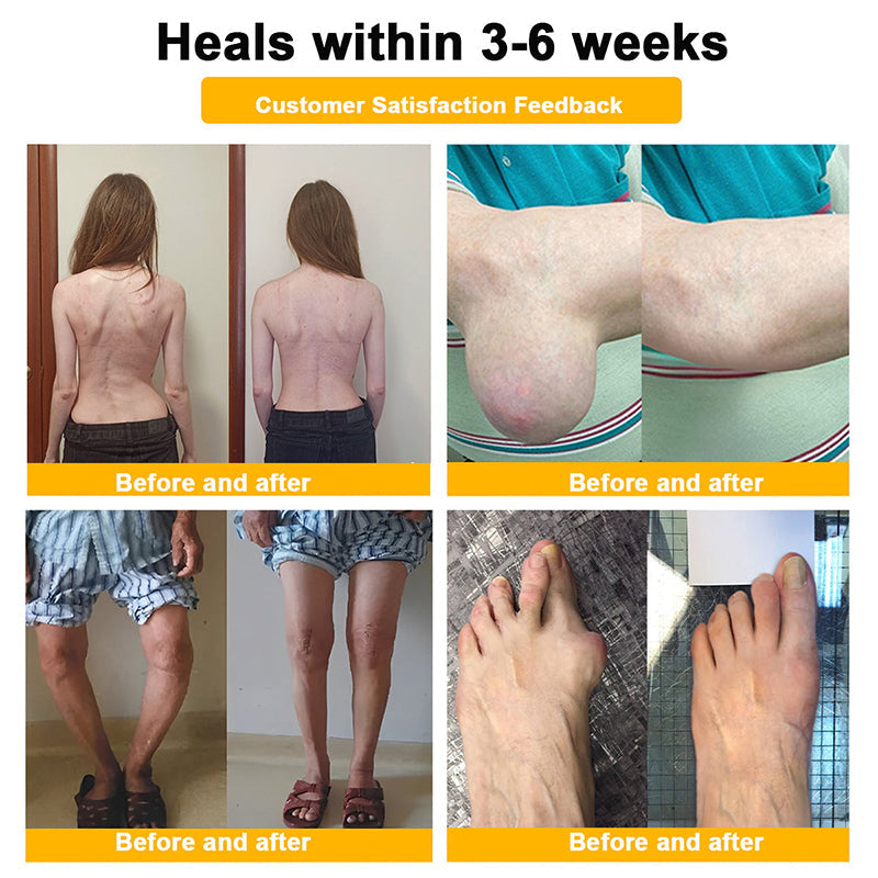 Myo Clinic BEE VENOM LITHOSPERMUM Pain-Relief Bone Healing Cream 👑(Specially for older adults)