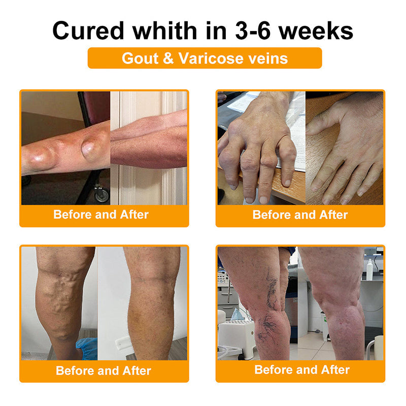 Myo Clinic BEE VENOM LITHOSPERMUM Pain-Relief Bone Healing Cream 👑(Specially for older adults)