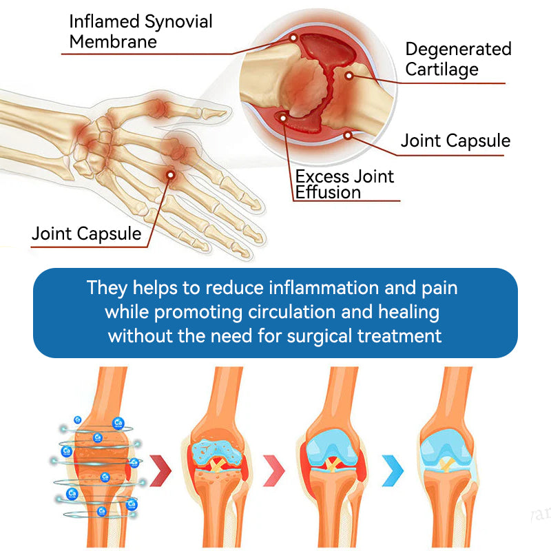 🇺🇸 LOTMAY® BPC-157 Joint & Muscle Treatment Cream🦴Treats Arthritis, Neuropathy, Rheumatism, Sports Injuries & More 🌹
