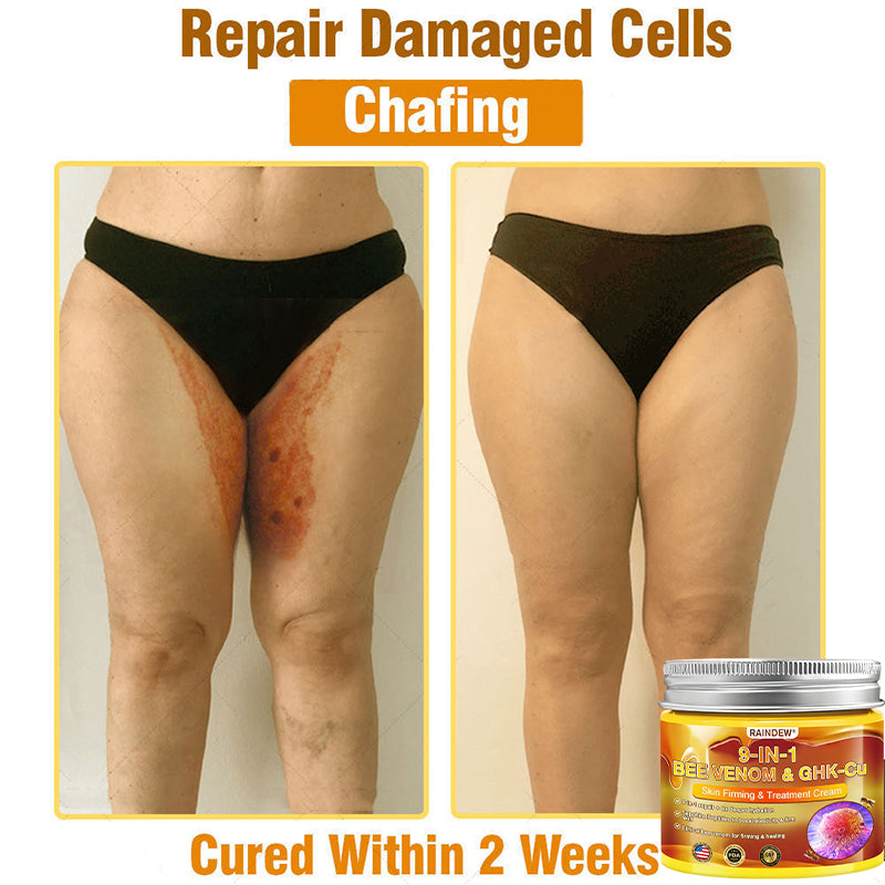 【Official Shop】RAINDEW® 9-IN-1 BEE VENOM & GHK-Cu Skin Firming & Treatment Cream Anti-aging, Hydrating, Skin Repair, Even Tone, Acne and Dark Spot Treatment, Wart and Mole Removal, Psoriasis Relief