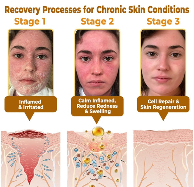 【Official Shop】RAINDEW® 9-IN-1 BEE VENOM & GHK-Cu Skin Firming & Treatment Cream Anti-aging, Hydrating, Skin Repair, Even Tone, Acne and Dark Spot Treatment, Wart and Mole Removal, Psoriasis Relief