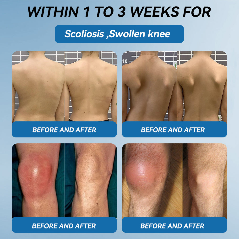 🇺🇸 LOTMAY® BPC-157 Joint & Muscle Treatment Cream🦴Treats Arthritis, Neuropathy, Rheumatism, Sports Injuries & More 🌹