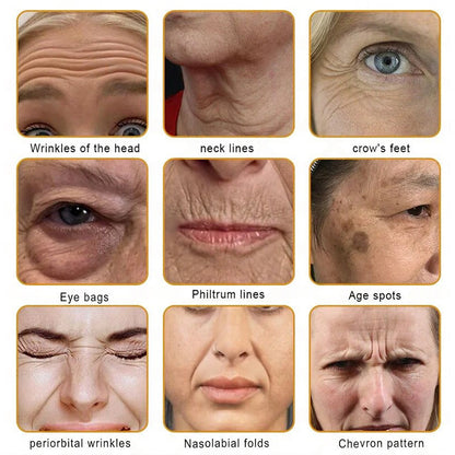 【Official Shop】RAINDEW® 9-IN-1 BEE VENOM & GHK-Cu Skin Firming & Treatment Cream Anti-aging, Hydrating, Skin Repair, Even Tone, Acne and Dark Spot Treatment, Wart and Mole Removal, Psoriasis Relief