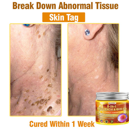 【Official Shop】RAINDEW® 9-IN-1 BEE VENOM & GHK-Cu Skin Firming & Treatment Cream Anti-aging, Hydrating, Skin Repair, Even Tone, Acne and Dark Spot Treatment, Wart and Mole Removal, Psoriasis Relief