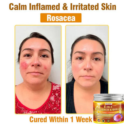 【Official Shop】RAINDEW® 9-IN-1 BEE VENOM & GHK-Cu Skin Firming & Treatment Cream Anti-aging, Hydrating, Skin Repair, Even Tone, Acne and Dark Spot Treatment, Wart and Mole Removal, Psoriasis Relief