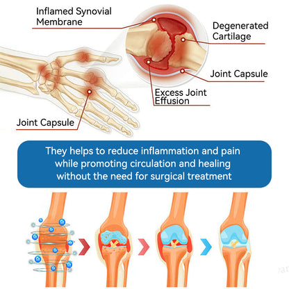 🇺🇸 LOTMAY® BPC-157 Joint & Muscle Treatment Cream🦴Treats Arthritis, Neuropathy, Rheumatism, Sports Injuries & More 🌹