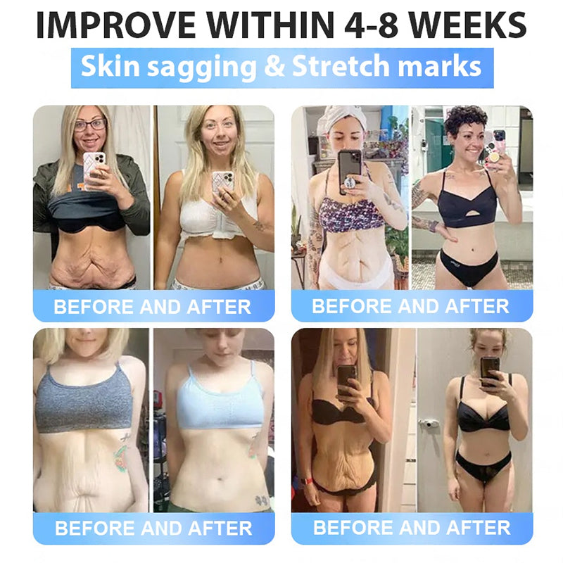 🇺🇸FDA Official Store | Myo Clinic GLP-1 Slim & Firm Nano Microneedle Patch with Collagen, Turmeric & Matrixyl 3000丨Obesity, Cardiovascular Disease, Diabetes, Sleep Apnea, Joint Problems and More