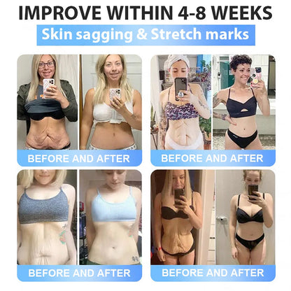 🇺🇸FDA Official Store | Myo Clinic GLP-1 Slim & Firm Nano Microneedle Patch with Collagen, Turmeric & Matrixyl 3000丨Obesity, Cardiovascular Disease, Diabetes, Sleep Apnea, Joint Problems and More