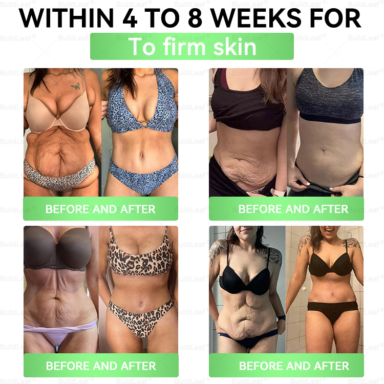 🇺🇸 US Online | Honxi® GLP-1 9-in-1 Slim & Healthy Oral Solution(𝑂𝑛𝑐𝑒 𝑎 𝑑𝑎𝑦, 𝑣𝑖𝑠𝑖𝑏𝑙𝑒 𝑟𝑒𝑠𝑢𝑙𝑡𝑠 𝑖𝑛 7 𝑑𝑎𝑦𝑠)  ✅ 𝗦𝘂𝗽𝗽𝗼𝗿𝘁𝘀 𝗼𝗯𝗲𝘀𝗶𝘁𝘆, 𝗰𝗮𝗿𝗱𝗶𝗼𝘃𝗮𝘀𝗰𝘂𝗹𝗮𝗿 𝗵𝗲𝗮𝗹𝘁𝗵, 𝗱𝗶𝗮𝗯𝗲𝘁𝗲𝘀, 𝘀𝗹𝗲𝗲𝗽 𝗮𝗽𝗻𝗲𝗮, 𝗴𝘂𝘁 𝗵𝗲𝗮𝗹𝘁𝗵, 𝗷𝗼𝗶𝗻𝘁 𝗶𝘀𝘀𝘂𝗲𝘀, 𝐰𝐡𝐢𝐥𝐞 𝐚𝐥𝐬𝐨 𝐟𝐢𝐫𝐦𝐢𝐧𝐠 𝐭𝐡𝐞 𝐬𝐤𝐢𝐧 𝐚𝐧𝐝 𝐛𝐨𝐨𝐬𝐭𝐢𝐧𝐠 𝐞𝐧𝐞𝐫𝐠𝐲.