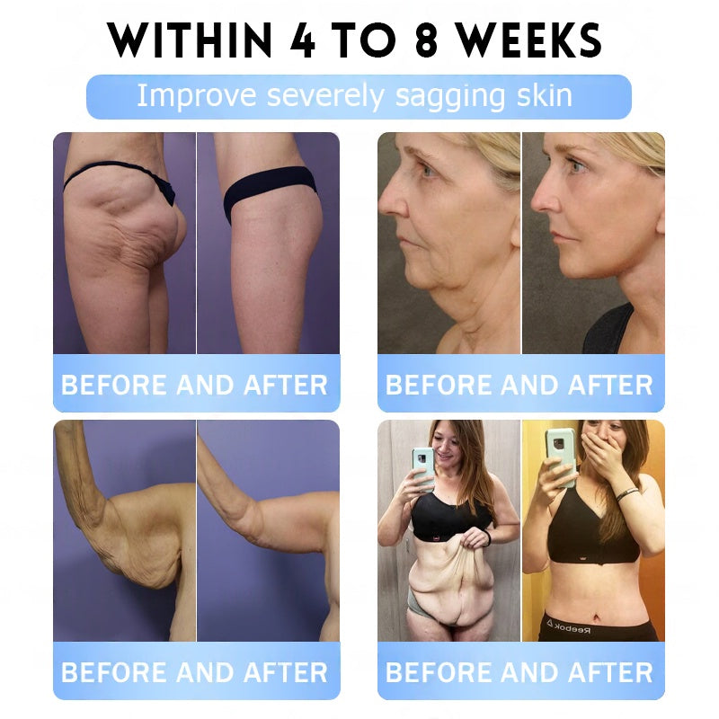 🇺🇸FDA Official Store | Myo Clinic GLP-1 Slim & Firm Nano Microneedle Patch with Collagen, Turmeric & Matrixyl 3000丨Obesity, Cardiovascular Disease, Diabetes, Sleep Apnea, Joint Problems and More