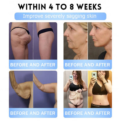 🇺🇸FDA Official Store | Myo Clinic GLP-1 Slim & Firm Nano Microneedle Patch with Collagen, Turmeric & Matrixyl 3000丨Obesity, Cardiovascular Disease, Diabetes, Sleep Apnea, Joint Problems and More