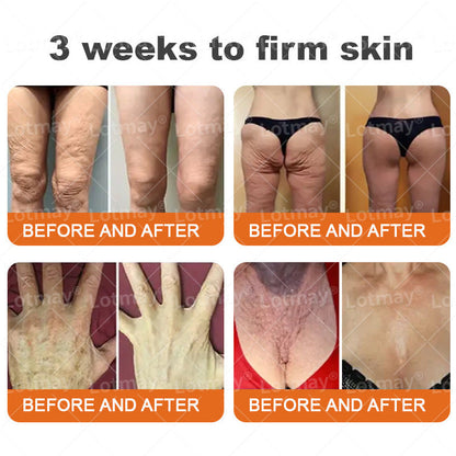 𝐂𝐨𝐨𝐥𝐨𝐫𝐝 𝐅𝐢𝐫𝐦𝐢𝐧𝐠 & 𝐑𝐞𝐧𝐞𝐰𝐚𝐥 𝐂𝐫𝐞𝐚𝐦: 𝐑𝐞𝐬𝐭𝐨𝐫𝐞 𝐒𝐤𝐢𝐧 𝐄𝐥𝐚𝐬𝐭𝐢𝐜𝐢𝐭𝐲