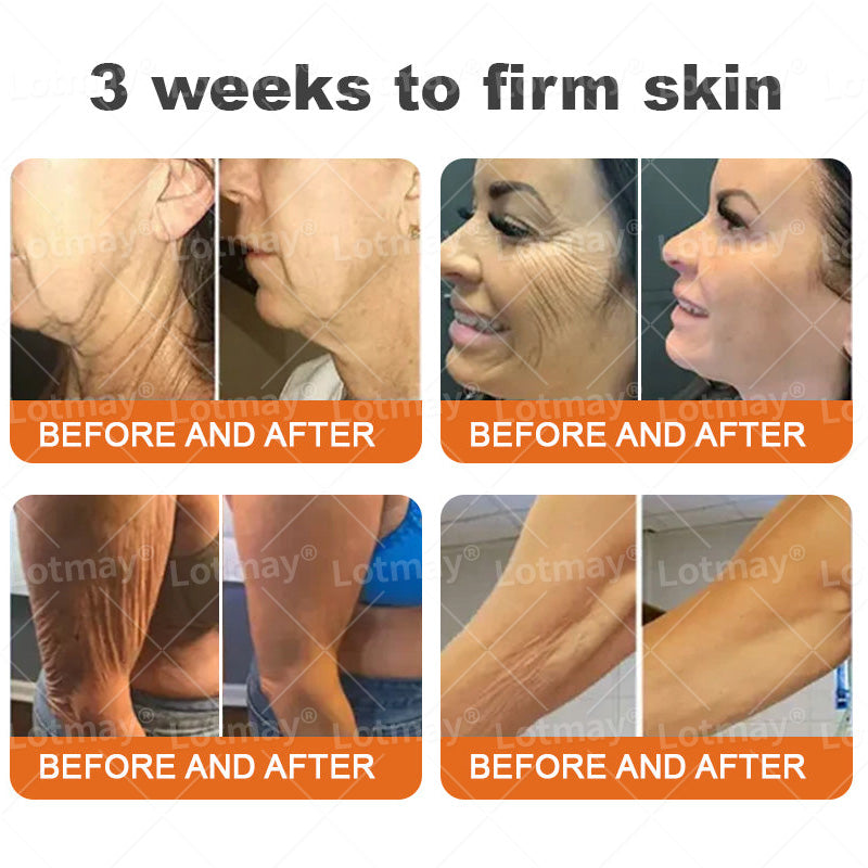 𝐂𝐨𝐨𝐥𝐨𝐫𝐝 𝐅𝐢𝐫𝐦𝐢𝐧𝐠 & 𝐑𝐞𝐧𝐞𝐰𝐚𝐥 𝐂𝐫𝐞𝐚𝐦: 𝐑𝐞𝐬𝐭𝐨𝐫𝐞 𝐒𝐤𝐢𝐧 𝐄𝐥𝐚𝐬𝐭𝐢𝐜𝐢𝐭𝐲