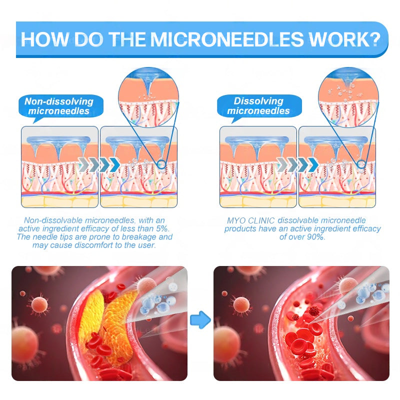 🇺🇸FDA Official Store | Myo Clinic GLP-1 Slim & Firm Nano Microneedle Patch with Collagen, Turmeric & Matrixyl 3000丨Obesity, Cardiovascular Disease, Diabetes, Sleep Apnea, Joint Problems and More
