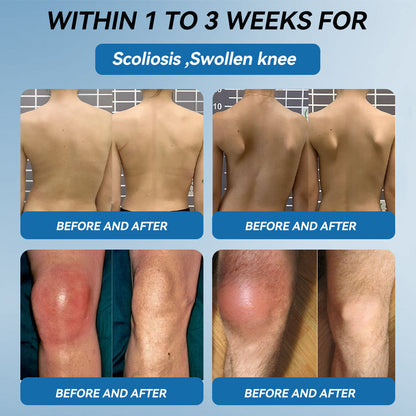 🇺🇸 LOTMAY® BPC-157 Joint & Muscle Treatment Cream🦴Treats Arthritis, Neuropathy, Rheumatism, Sports Injuries & More 🌹