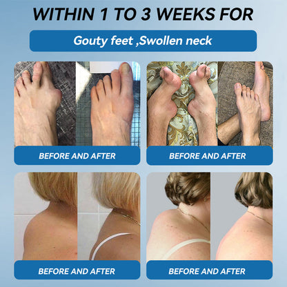 🇺🇸 LOTMAY® BPC-157 Joint & Muscle Treatment Cream🦴Treats Arthritis, Neuropathy, Rheumatism, Sports Injuries & More 🌹