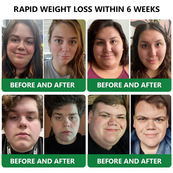 Honxi® Slimming & health NANO MICRONEEDLE PATCH 👩‍⚕️Suitable for obesity, cardiovascular diseases, diabetes, sleep apnea, high cholesterol and blood lipids, joint problems, and various other conditions