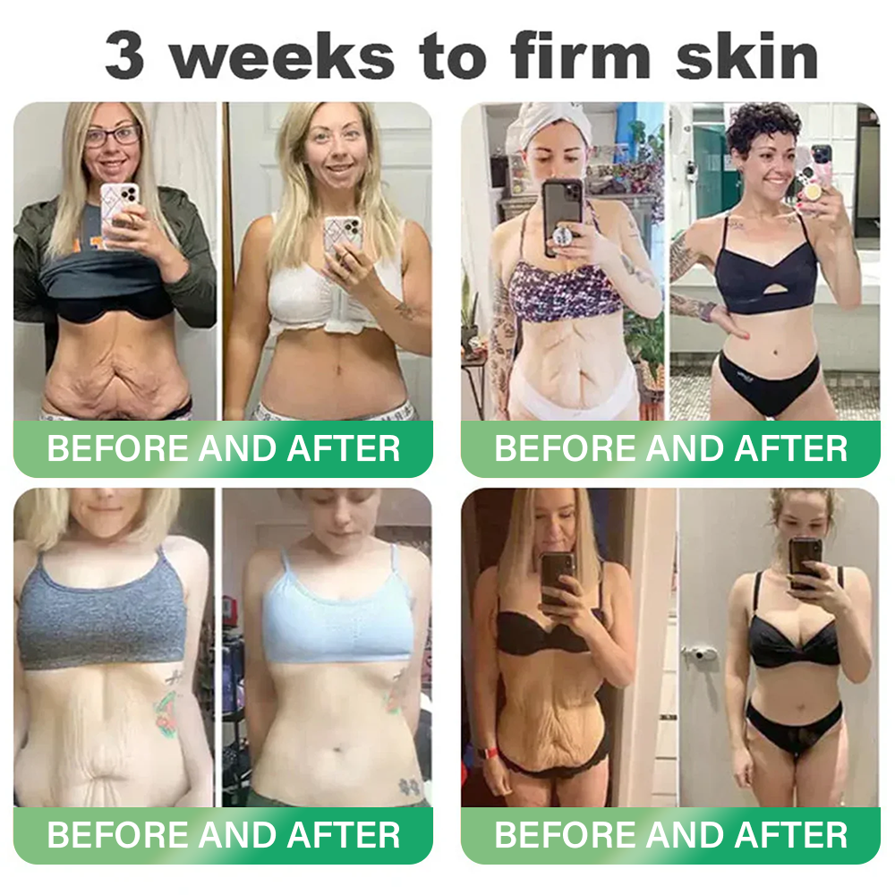 🇺🇸𝑶𝒇𝒇𝒊𝒄𝒊𝒂𝒍 𝑺𝒕𝒐𝒓𝒆|𝐇𝐨𝐧𝐱𝐢® 𝐍𝐀𝐃+ 𝐆𝐋𝐏-𝟏 𝐒𝐢𝐱 𝐢𝐧 𝐎𝐧𝐞 𝐇𝐞𝐚𝐥𝐭𝐡 𝐒𝐨𝐥𝐮𝐭𝐢𝐨𝐧 𝐎𝐫𝐚𝐥 𝐋𝐢𝐪𝐮𝐢𝐝 (𝐉𝐮𝐬𝐭 𝐨𝐧𝐜𝐞 𝐚 𝐝𝐚𝐲, 𝐯𝐢𝐬𝐢𝐛𝐥𝐞 𝐜𝐡𝐚𝐧𝐠𝐞𝐬 𝐢𝐧 𝟕 𝐝𝐚𝐲𝐬） ✅ 𝐅𝐨𝐫 𝐨𝐛𝐞𝐬𝐢𝐭𝐲, 𝐜𝐚𝐫𝐝𝐢𝐨𝐯𝐚𝐬𝐜𝐮𝐥𝐚𝐫 𝐡𝐞𝐚𝐥𝐭𝐡, 𝐝𝐢𝐚𝐛𝐞𝐭𝐞𝐬, 𝐬𝐥𝐞𝐞𝐩 𝐚𝐩𝐧𝐞𝐚, 𝐆𝐮𝐭 𝐇𝐞𝐚𝐥𝐭𝐡, 𝐣𝐨𝐢𝐧𝐭 𝐢𝐬𝐬𝐮𝐞𝐬, 𝐚𝐧𝐝 𝐦𝐨𝐫𝐞