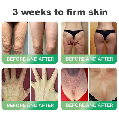 🇺🇸𝑶𝒇𝒇𝒊𝒄𝒊𝒂𝒍 𝑺𝒕𝒐𝒓𝒆|𝐇𝐨𝐧𝐱𝐢® 𝐍𝐀𝐃+ 𝐆𝐋𝐏-𝟏 𝐒𝐢𝐱 𝐢𝐧 𝐎𝐧𝐞 𝐇𝐞𝐚𝐥𝐭𝐡 𝐒𝐨𝐥𝐮𝐭𝐢𝐨𝐧 𝐎𝐫𝐚𝐥 𝐋𝐢𝐪𝐮𝐢𝐝 (𝐉𝐮𝐬𝐭 𝐨𝐧𝐜𝐞 𝐚 𝐝𝐚𝐲, 𝐯𝐢𝐬𝐢𝐛𝐥𝐞 𝐜𝐡𝐚𝐧𝐠𝐞𝐬 𝐢𝐧 𝟕 𝐝𝐚𝐲𝐬） ✅ 𝐅𝐨𝐫 𝐨𝐛𝐞𝐬𝐢𝐭𝐲, 𝐜𝐚𝐫𝐝𝐢𝐨𝐯𝐚𝐬𝐜𝐮𝐥𝐚𝐫 𝐡𝐞𝐚𝐥𝐭𝐡, 𝐝𝐢𝐚𝐛𝐞𝐭𝐞𝐬, 𝐬𝐥𝐞𝐞𝐩 𝐚𝐩𝐧𝐞𝐚, 𝐆𝐮𝐭 𝐇𝐞𝐚𝐥𝐭𝐡, 𝐣𝐨𝐢𝐧𝐭 𝐢𝐬𝐬𝐮𝐞𝐬, 𝐚𝐧𝐝 𝐦𝐨𝐫𝐞