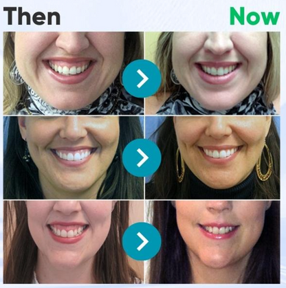 Hermsa® VioGloss Bee Venom Dental Therapy Oral Power